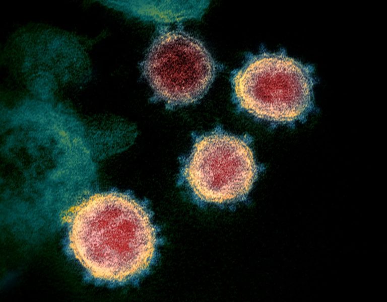 COVID-19 infections and deaths on the rise in Iowa as vaccinations stall